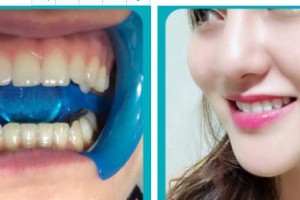 泰州泰勒美整形美容醫(yī)院王志忠整形價(jià)格表附冷光美白案例展示