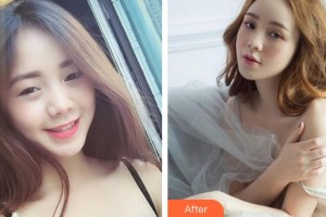 泰州麗都醫(yī)療美容醫(yī)院李艷整形價格表附眼部綜合案例展示