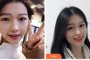 永州牙博士口腔醫(yī)院曾憲華整形價(jià)格表附牙齒隱形矯正案例展示