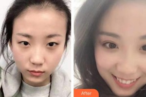 金昌市中西醫(yī)結合醫(yī)院眼科整形價格表附眼部綜合案例展示