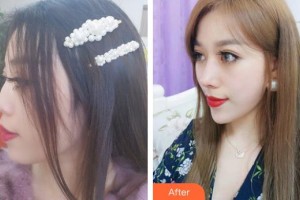 天水瑪莉亞（原女子）醫(yī)院醫(yī)學整形中心傅天祥整形價格表附鼻部綜合案例展示