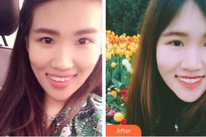 天水瑪莉亞（原女子）醫(yī)院醫(yī)學整形中心李兆鶴整形價格表附牙齒隱形矯正案例展示