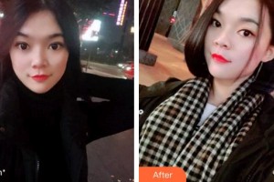 天水瑪莉亞（原女子）醫(yī)院醫(yī)學整形中心石正平整形價格表附牙齒隱形矯正案例展示