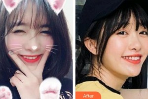 天水市中西醫(yī)結合醫(yī)院口腔頜面外科丁艷美整形價格表附冷光美白案例展示