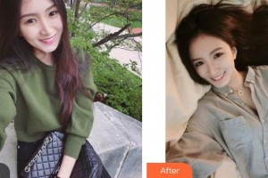 銀川愛美麗醫(yī)療美容門診部范元濤整形價格表附熱拉提案例展示