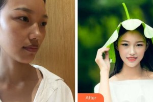 銀川愛美麗醫(yī)療美容門診部秦宏治整形價格表附射頻緊膚案例展示