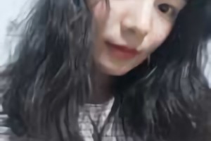 北京圣嘉榮醫(yī)療美容醫(yī)院磨骨好不好？附黃大勇磨骨案例