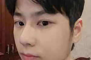 暨南大學(xué)附屬深圳華僑醫(yī)院季如恭下頜角整形怎么樣？附術(shù)后對(duì)比圖