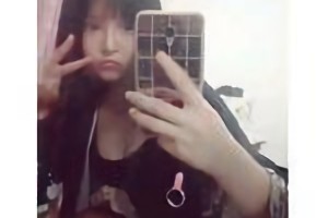 上海華美醫(yī)院李志海做的下頜角貴嗎？附案例日記分享