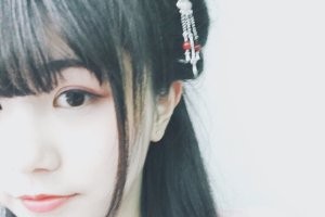 南昌時(shí)光醫(yī)療美容門診部隆鼻手術(shù)全過(guò)程展示 附果圖