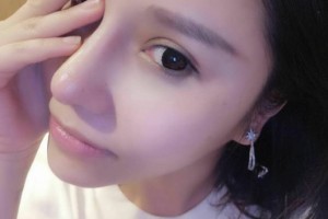 同濟大學附屬東方醫(yī)院醫(yī)生團隊如何？附隆鼻手術附果圖展示