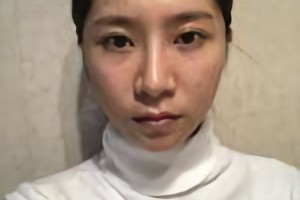 上海仁愛(ài)醫(yī)院劉先超磨骨怎么樣？附案例分享和較新價(jià)格表