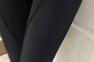 北京石景山八大處中西醫(yī)結(jié)合醫(yī)院正規(guī)嗎吸脂瘦腿手術(shù)附果圖