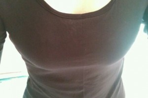 上海交通大學醫(yī)學院附屬第九人民醫(yī)院隆胸手術果太好了附價格表