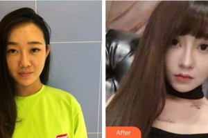 郴州維納斯醫(yī)療美容醫(yī)院黃致遠(yuǎn)整形價(jià)格表附無針?biāo)獍咐故?>
</a>
<h3 class=