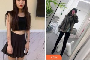 郴州美科醫(yī)療美容門診部彭奪斌整形價(jià)格表附激光祛疤案例展示