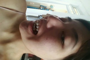 歡樂口腔醫(yī)院孫延牙齒矯正？醫(yī)生推薦+費用表