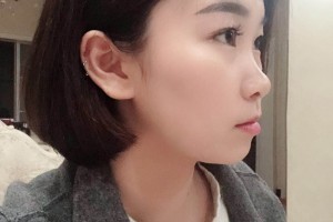 長(zhǎng)沙美奧口腔醫(yī)院環(huán)境怎么樣熊安鳳牙齒矯正附果圖和價(jià)格表