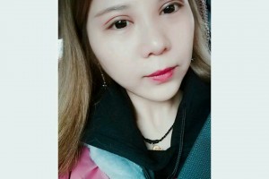 徐州市中心醫(yī)院整形美容中心賀小虎技術好不好附割雙眼皮案例