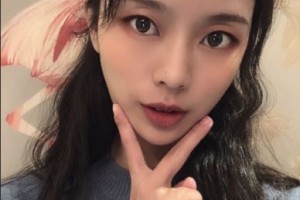 上海首爾麗格醫(yī)療美容醫(yī)院樸興植顴骨手術附果圖