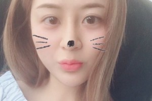 鄭州大學(xué)第五附屬醫(yī)院董琪隆鼻手術(shù)果好不好附案例分享和價(jià)格表