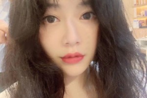 北京大學(xué)第三醫(yī)院環(huán)境怎么樣閆愛萍醫(yī)生植發(fā)手術(shù)果分享和價格表