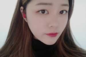 杭州時光醫(yī)療美容醫(yī)院河東鎬醫(yī)生怎么樣？附磨骨案例分享和價格表