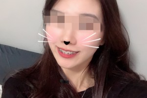 北京深圳大學(xué)醫(yī)院環(huán)境怎么樣牙齒矯正果分享附價格一覽