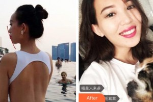 雞西王醫(yī)生整形外科門(mén)診部郝國(guó)梁整形價(jià)格表附牙齒陶瓷矯正案例展示