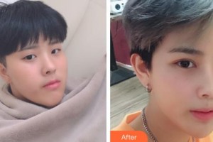 咸陽市第一人民醫(yī)院眼科醫(yī)院王彤整形價格表附眼部綜合案例展示