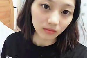 廣州廣大醫(yī)院王政醫(yī)生磨骨好不好附案例和價(jià)格一覽