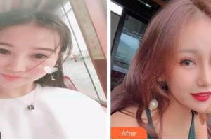 大理華山眼科醫(yī)院洪波整形價(jià)格表附眼部綜合案例展示