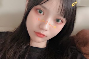 豐臺右安門醫(yī)院顴骨手術|附果圖+新版價格表