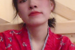 北京聯合麗格醫(yī)院怎么樣下頜角切除手術展示|價格表