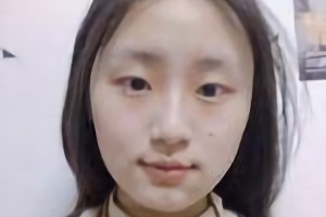 北京圣嘉榮醫(yī)療美容醫(yī)院口碑怎么樣？附案例分享|醫(yī)生推薦