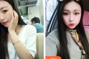 邯鄲市眼科醫(yī)院趙玉霞整形價(jià)格表附切開(kāi)雙眼皮案例展示