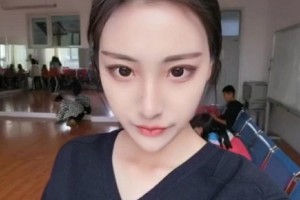 北京圣嘉新醫(yī)院顴骨/術后恢復經驗+較新價格表