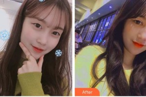 深圳?，斄猪槼毖劭漆t(yī)院尼思特整形價格表附眼部綜合案例展示