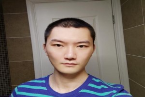 韓國Face-line整形醫(yī)院真人案例分享|2021價格表