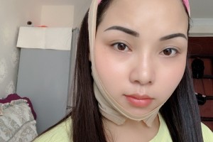 上海首爾麗格整形醫(yī)院下頜角/價(jià)格表+圖片對(duì)比