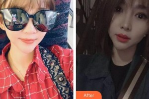 東莞韓美整形醫(yī)院黃玉潔主診醫(yī)師整形價格表附鼻部綜合案例展示