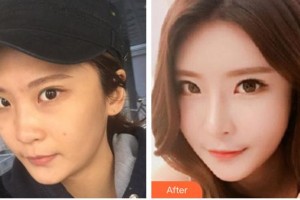 東莞王曉杰醫(yī)療美容診所王曉杰整形價格表附鼻部綜合案例展示