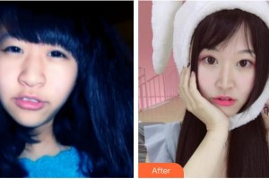 東莞華廈眼科醫(yī)院羅建整形價(jià)格表附眼部綜合案例展示