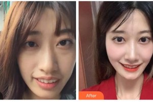 東莞恒生口腔門診部張帝整形價(jià)格表附牙齒陶瓷矯正案例展示