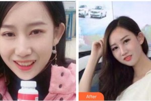 東莞拜爾口腔門診部陳亞軍整形價(jià)格表附口腔牙齒矯正案例展示