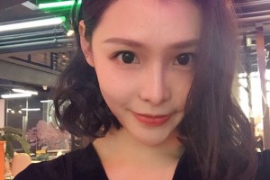 上海華美醫(yī)院下頜角手術怎么樣附手術過程分享