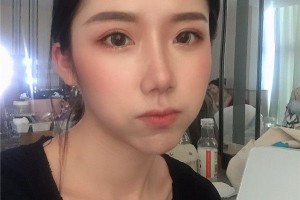 下頜角2021價格表上海時光整形醫(yī)院案例分享