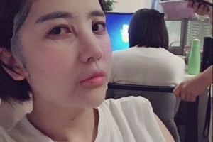 杭州市三醫(yī)院熱瑪吉果怎么樣附2021價格一覽