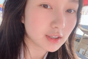 濟(jì)寧附屬醫(yī)院整形科下顎角感覺怎樣？真人案例圖片對比