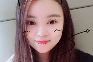 北京中日友好醫(yī)院怎么樣？附雙眼皮手術果圖